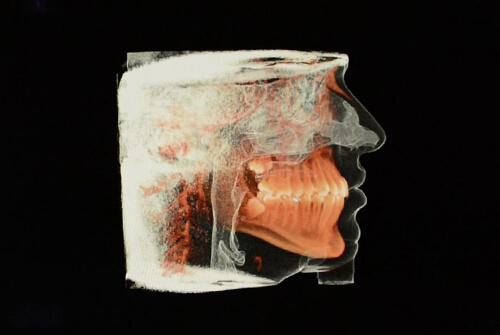 3D Dental Imaging