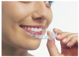 Invisalign Photo - Pt Holding Aligner